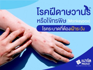 โรคฝีดาษลิงหรือไข้ทรพิษ (Smallpox) โรคระบาดที่ต้องเฝ้าระวัง